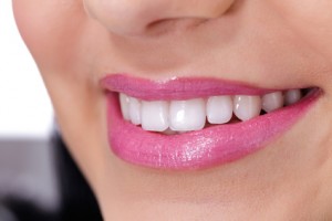 Weisse Zähne durch Zahn Bleaching