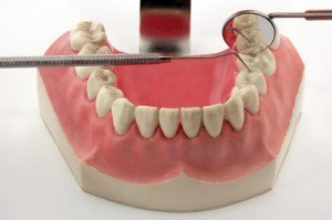 Suche nach einer Zahnfleischentzündung
