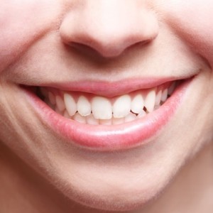 Lächelndes Gesicht mit schönem Zahnfleisch