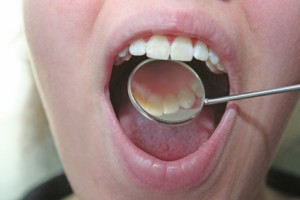 Untersuchung der Zähne